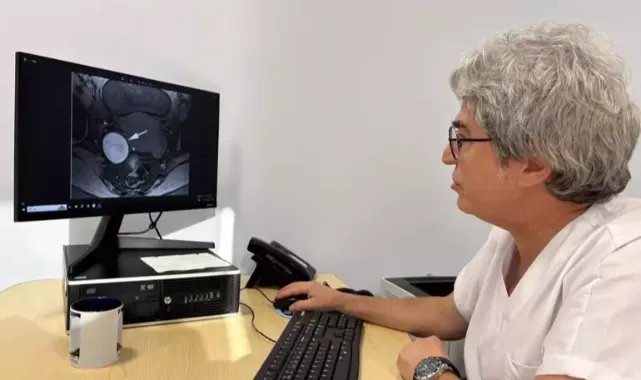 Endometriozis: Gizli Tehlikeler Ve Riskler