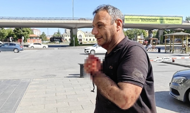 Kurban Kesiminde Yaralanmalara Dikkat!